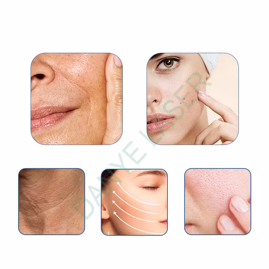 New Model Monopolar RF Skin Tightening Cet Ret Slimming Beauty Device for Home and Salon